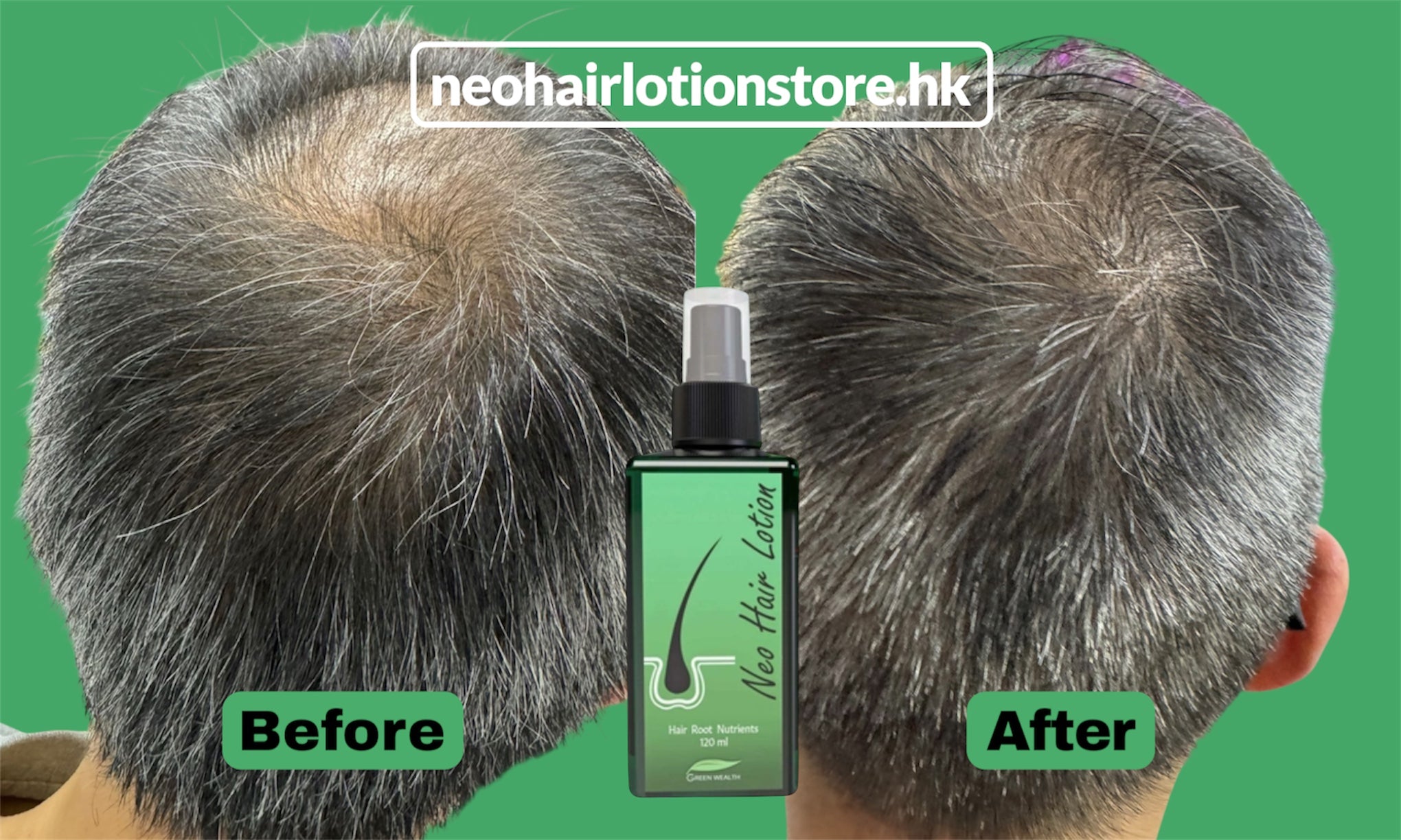 Before and after comparison of hair treatment with a bottle labeled 'neohairlotionstore.hk'.